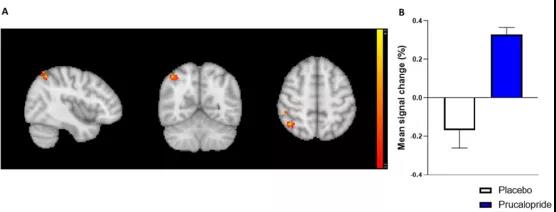 ?牛津科學家發現：通便也能通記憶，這種藥物或可促認知作用