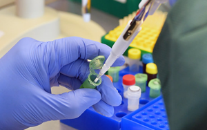 分子診斷用酶原料一站式服務(wù)盡在西寶生物 分子診斷用酶原料一站式服務(wù)盡在西寶生物