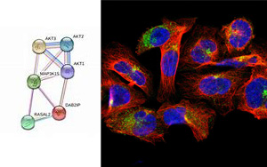 Science Advances:外顯子組測序研究發(fā)現(xiàn)糖尿病的潛在治療靶點(diǎn) Science Advances:外顯子組測序研究發(fā)現(xiàn)糖尿病的潛在治療靶點(diǎn)