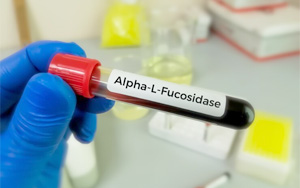 α-L-巖藻糖苷酶(AFU)檢測試劑盒用原輔料 α-L-巖藻糖苷酶(AFU)檢測試劑盒用原輔料