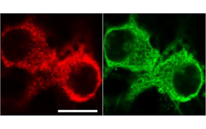 《PNAS》從過度反應蛋白合成到認知障礙,敲除1個基因即可 《PNAS》從過度反應蛋白合成到認知障礙,敲除1個基因即可