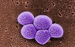 《Science》突破性新抗生素，遏制耐藥細菌