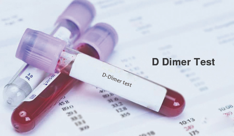 D-二聚體（D-Dimer）-磁微?；瘜W法學發光（AP/AE） /熒光免疫層析解決方案